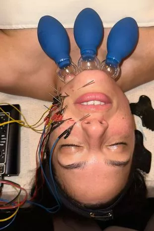 超级名模分享“看起来像恐怖电影”的美容手术,吓坏了粉丝