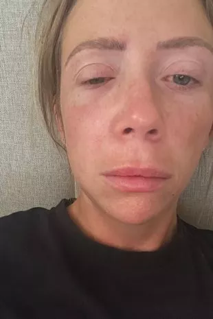 “我的整容手术太糟糕了,我不得不推迟婚礼。”